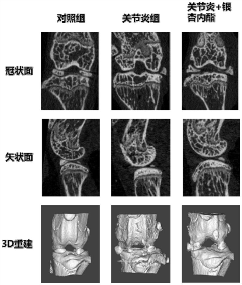 Ginkgo biloba extract for treating osteoarthritis