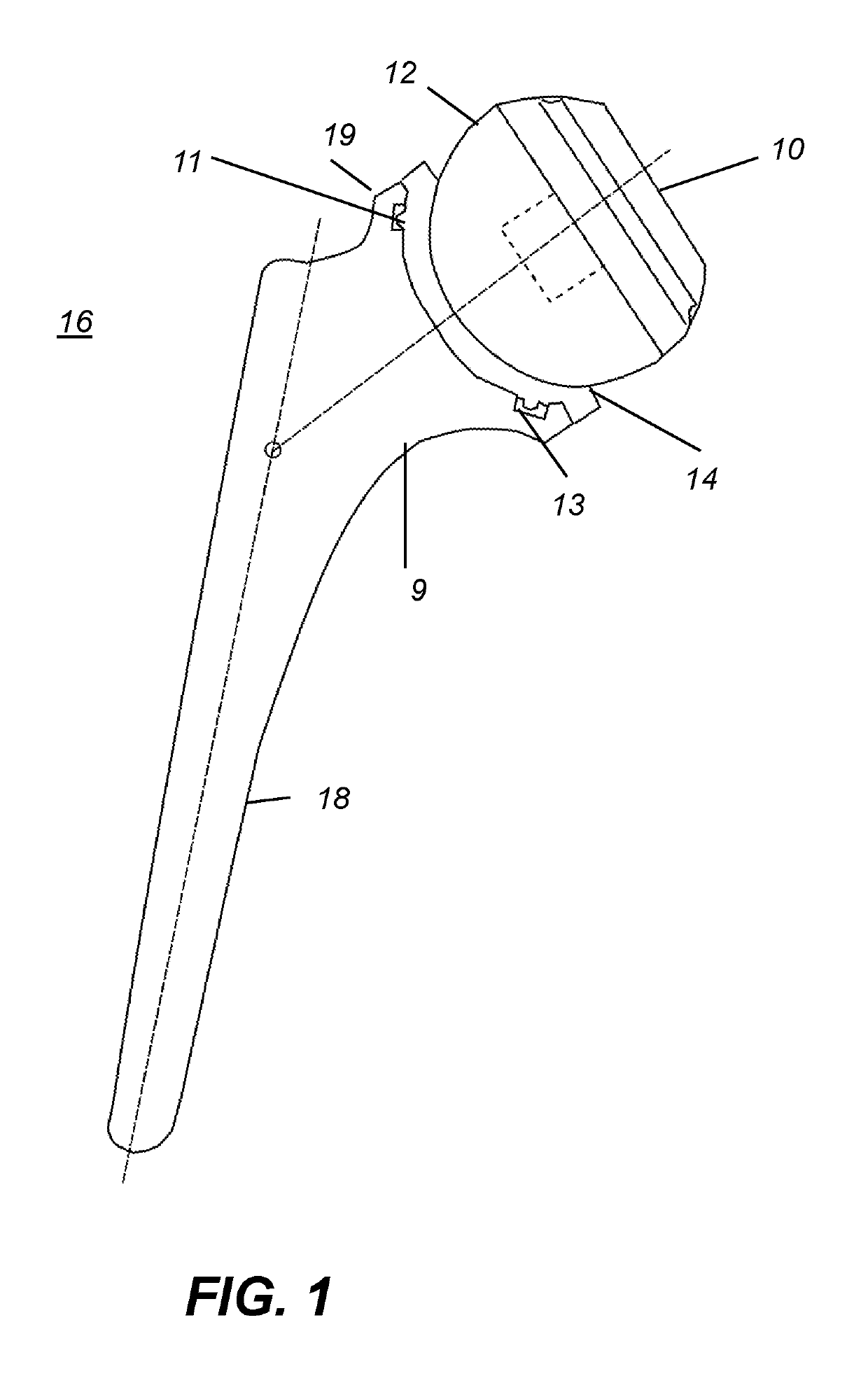 Reverse total hip replacement