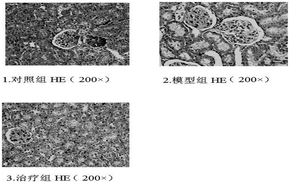 Chinese medicinal composition for preventing and treating renal ischemia reperfusion injury and preparation method thereof