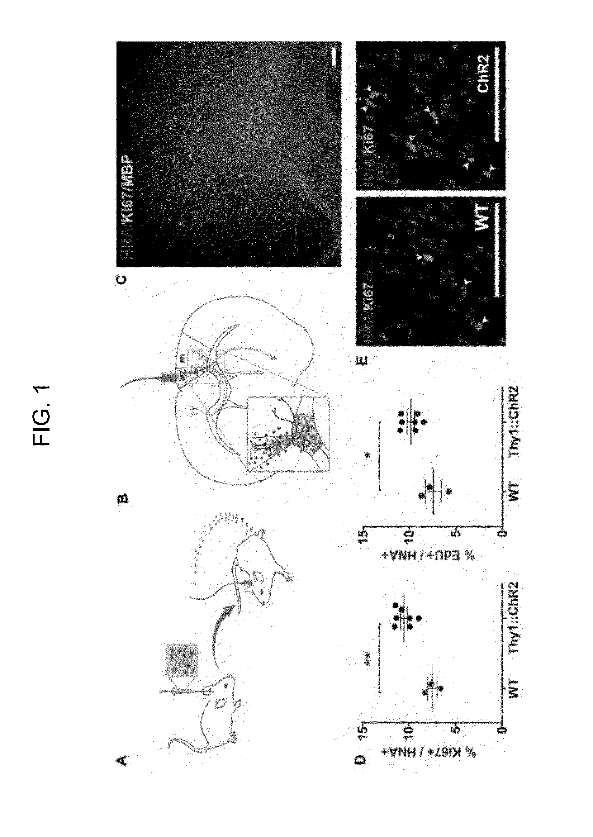 Method of Treating Glioma