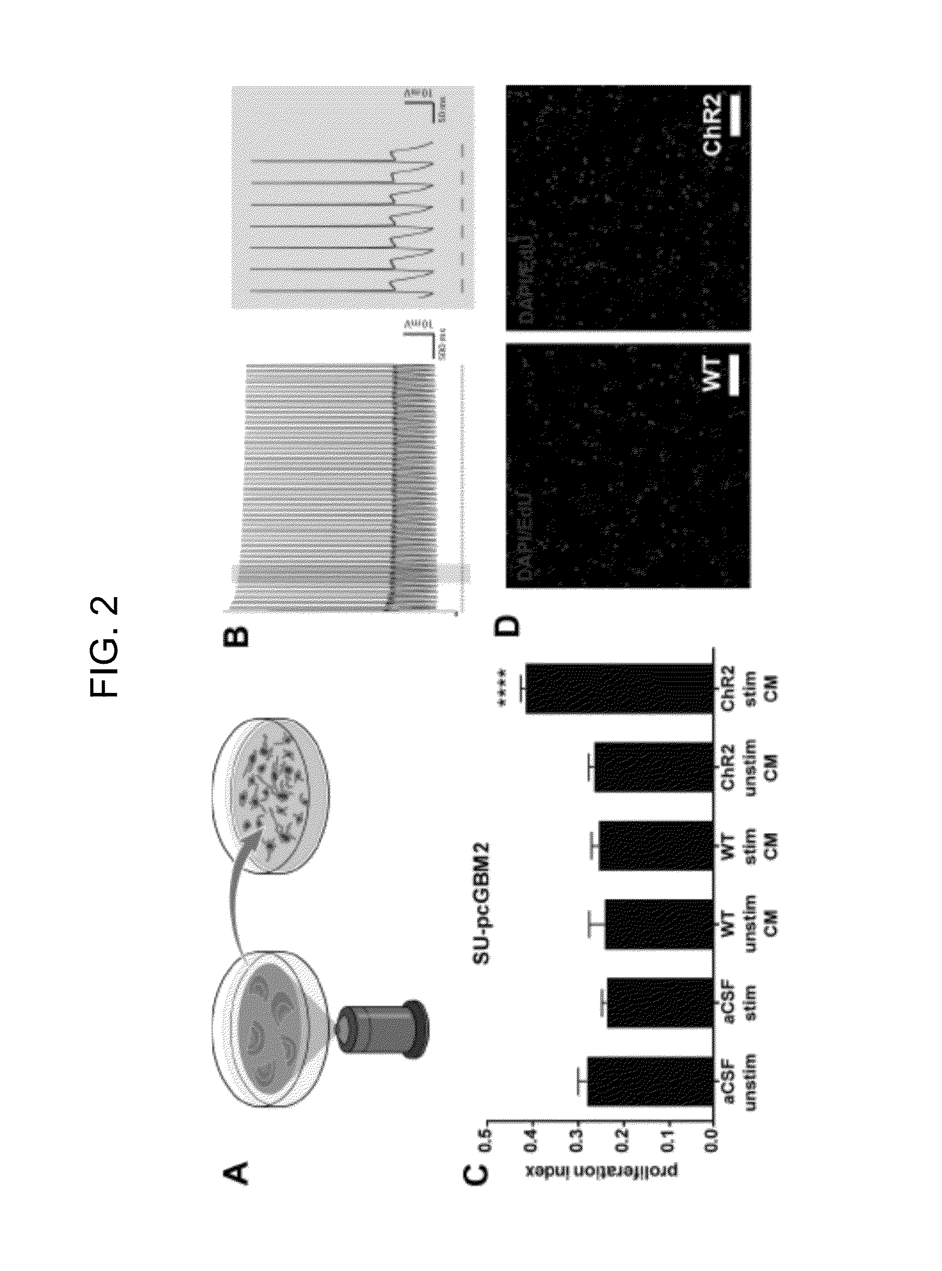 Method of Treating Glioma