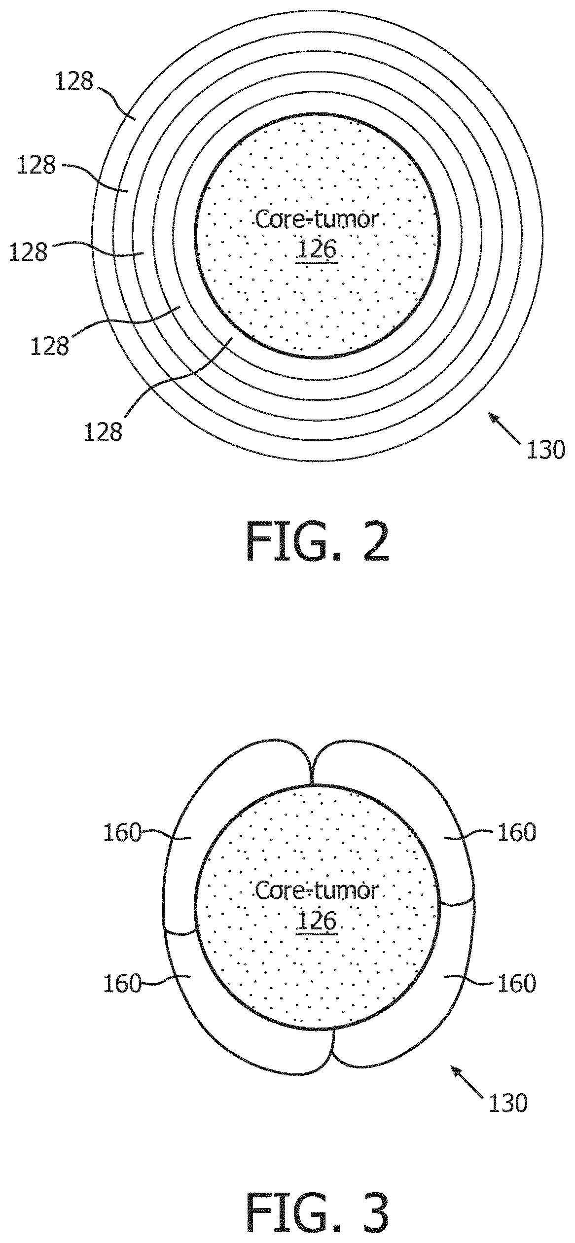 System and method for tumor ablation treatment planning including core tumor, margin and healthy tissue coverage