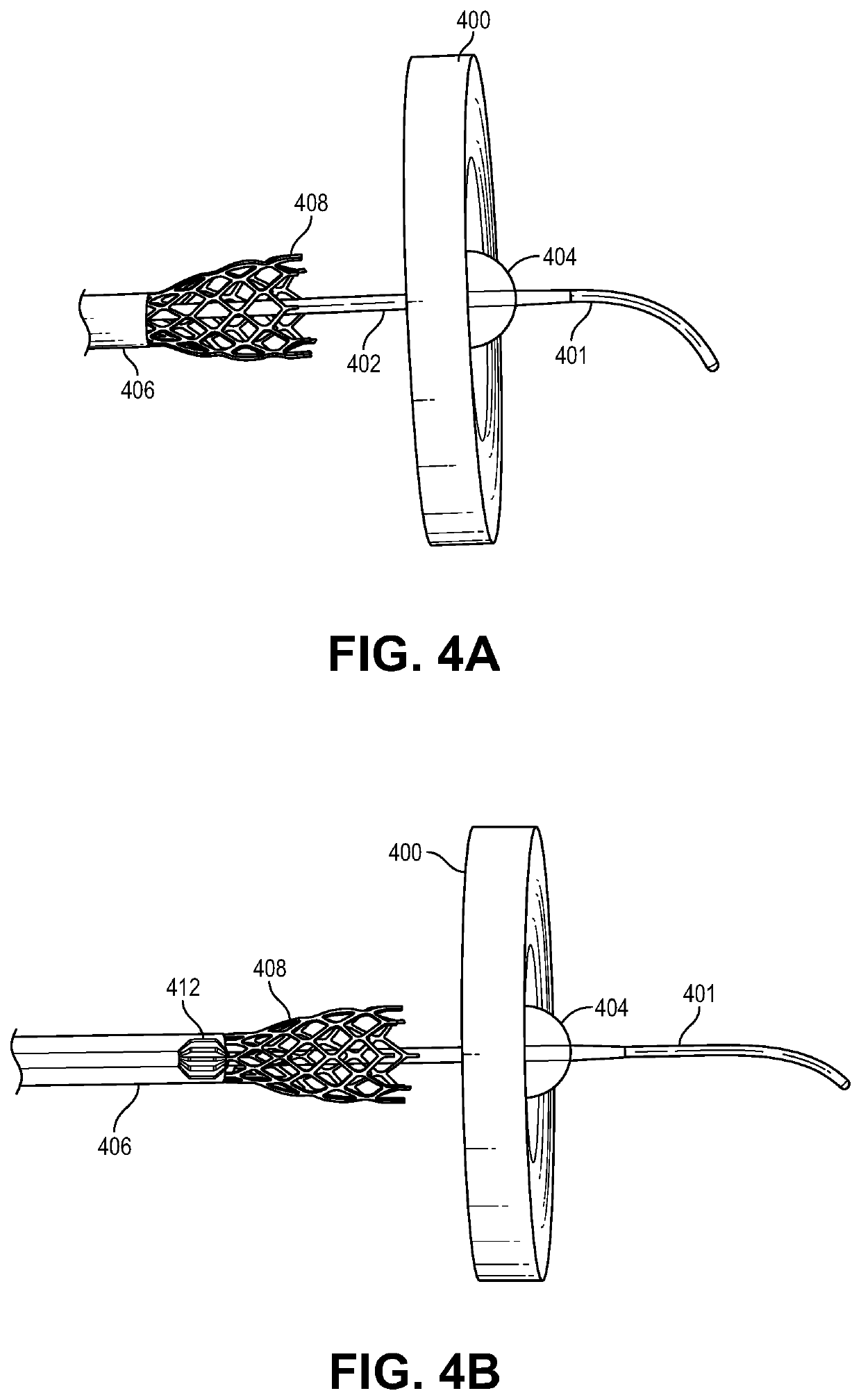 Transcatheter device for interatrial anastomosis