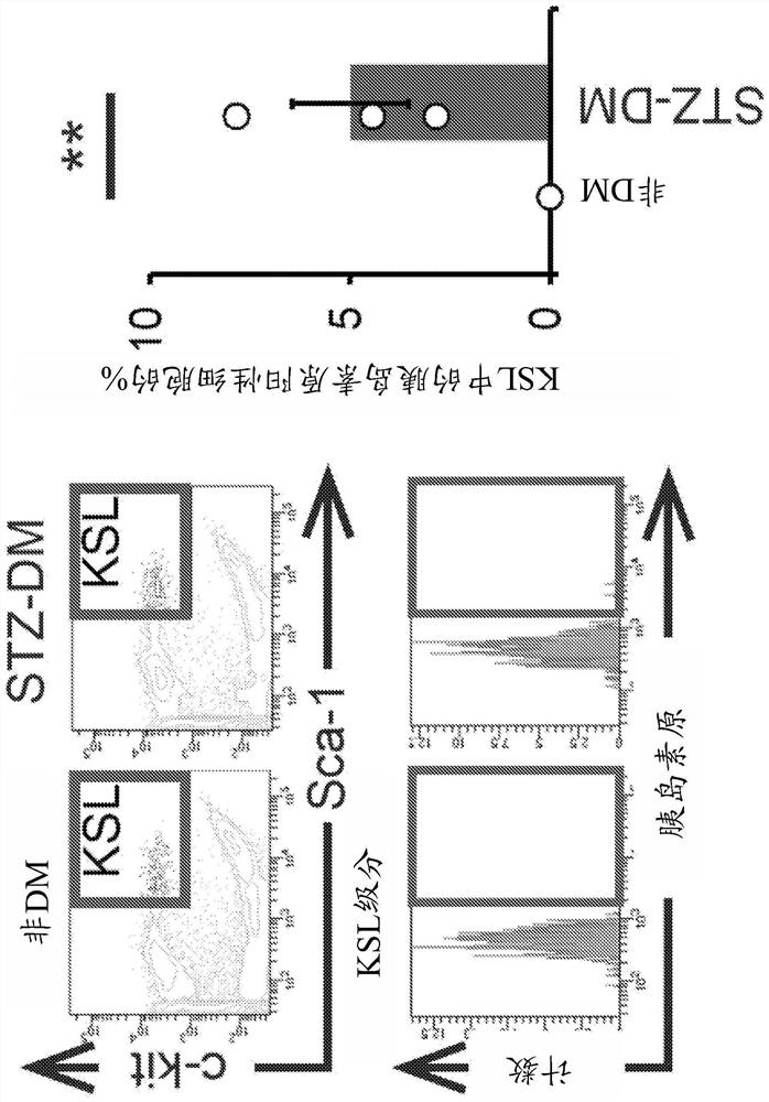 Diabetes treatment using stem cell migration agent