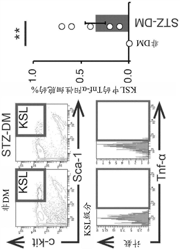 Diabetes treatment using stem cell migration agent