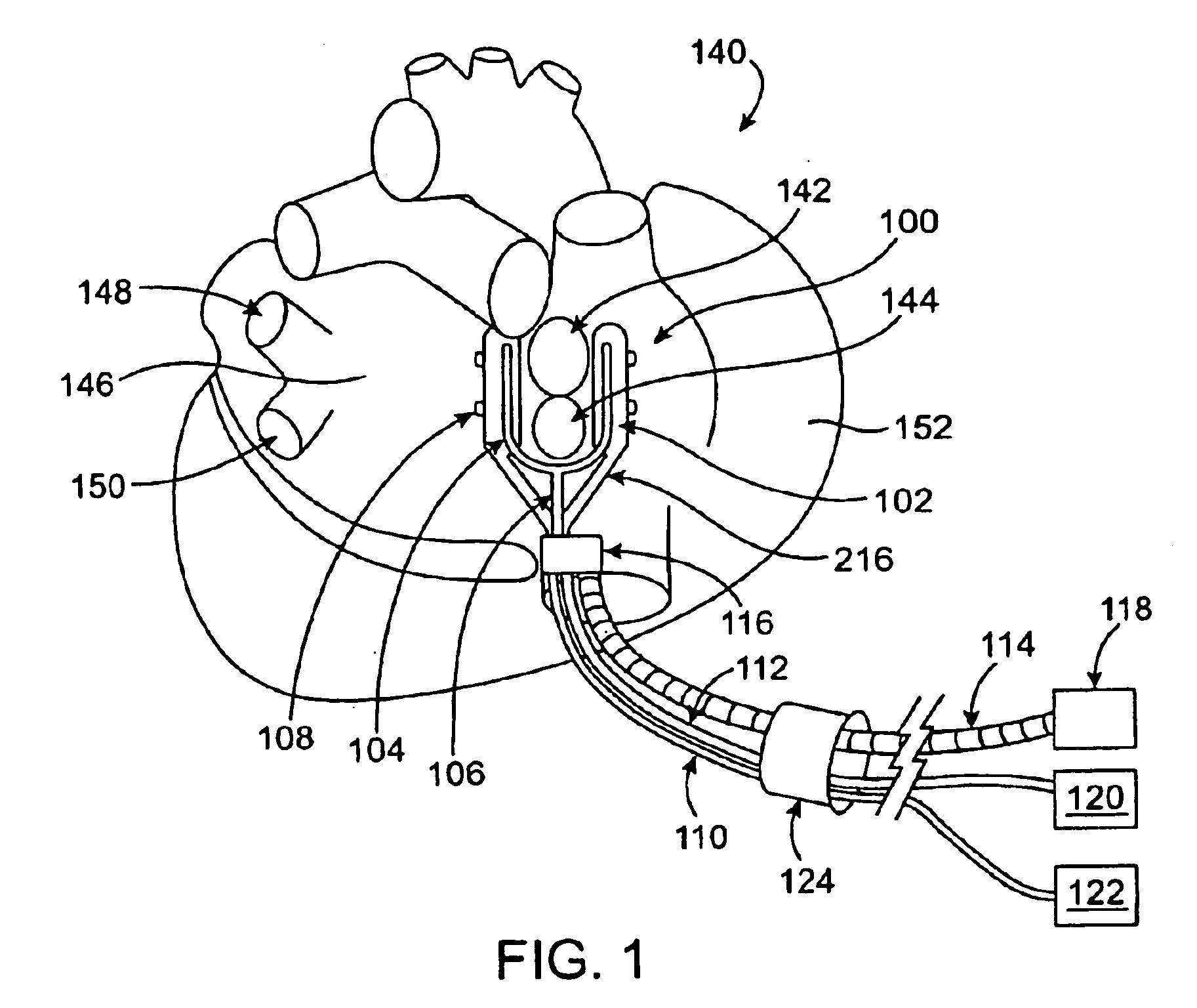 Cardiac ablation devices and methods