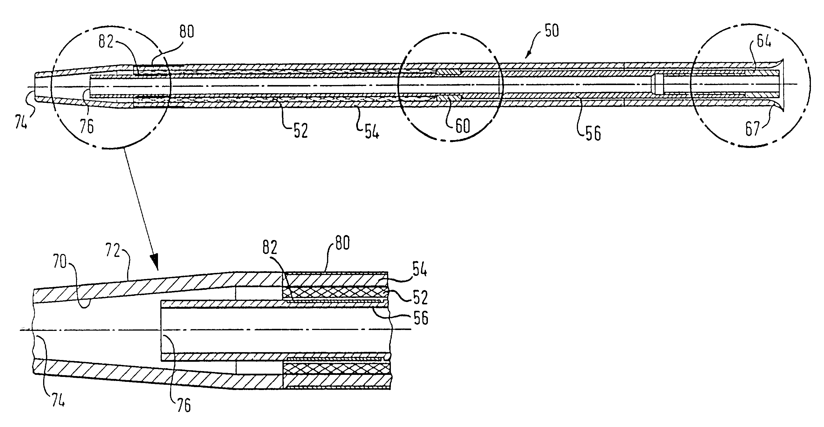 Implant delivery device