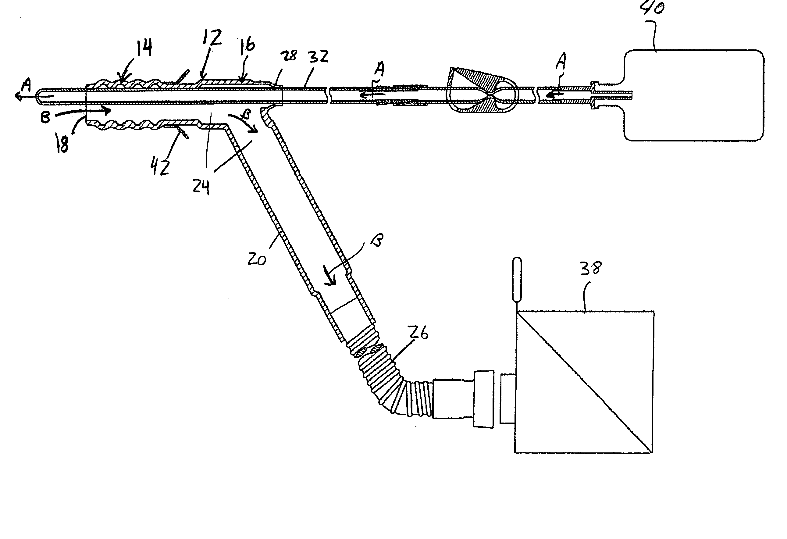 Device and method for colonic lavage