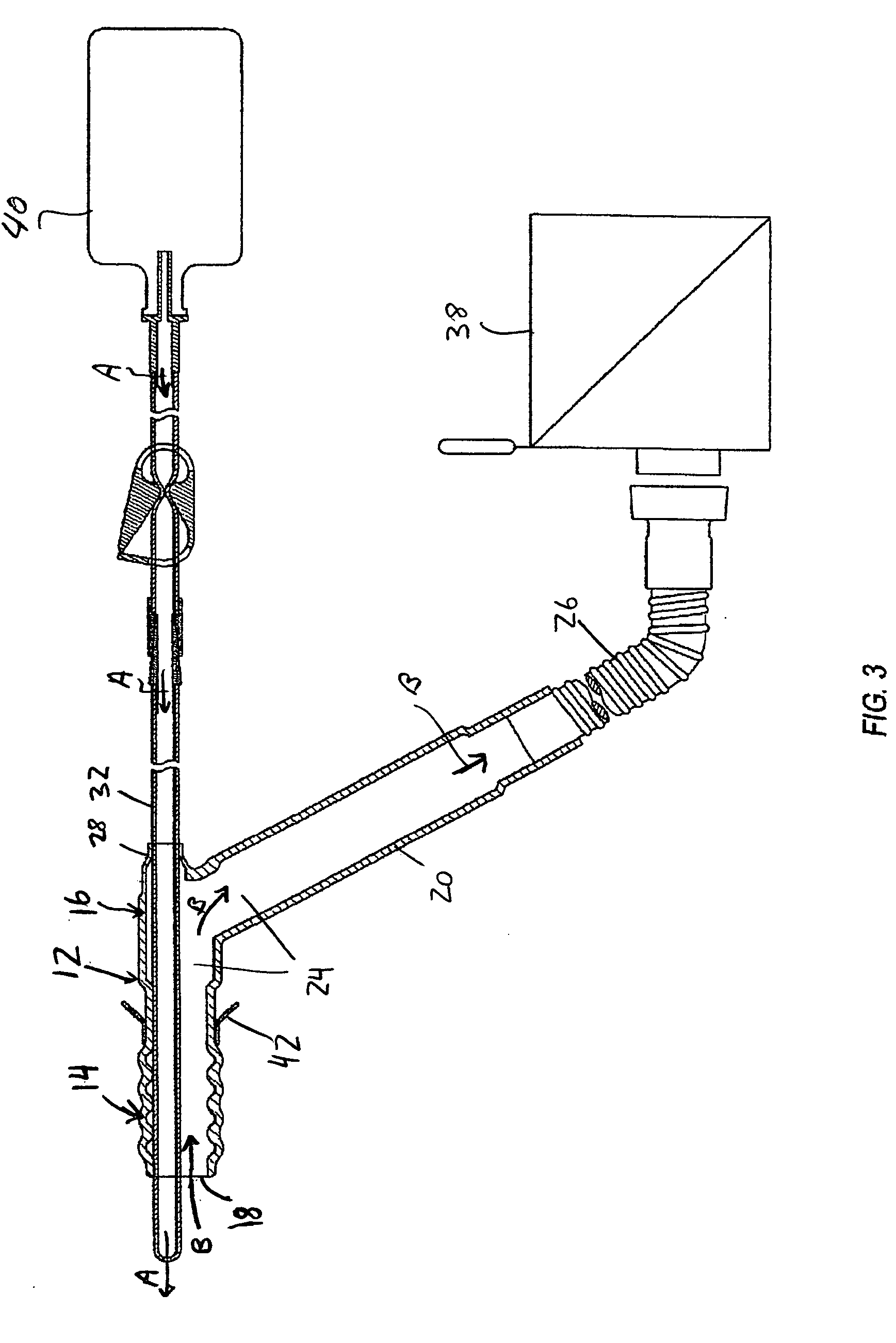 Device and method for colonic lavage