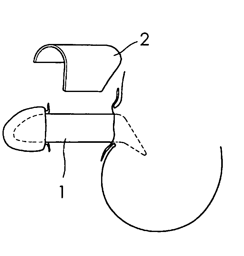 Novel methods of phalloplasty using multiple slits tissue or multiple pieces tissue