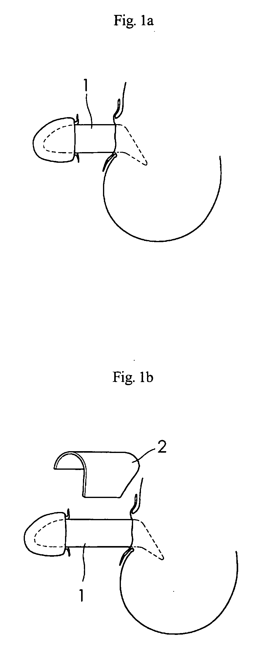 Novel methods of phalloplasty using multiple slits tissue or multiple pieces tissue