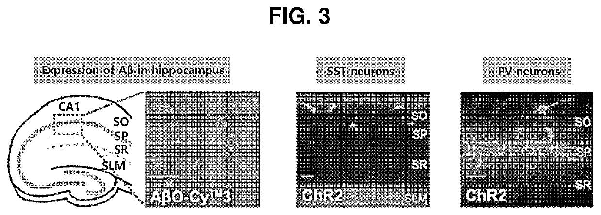 Method by which brain with alzheimer's disease recovers from brain wave damage by using optogenetics