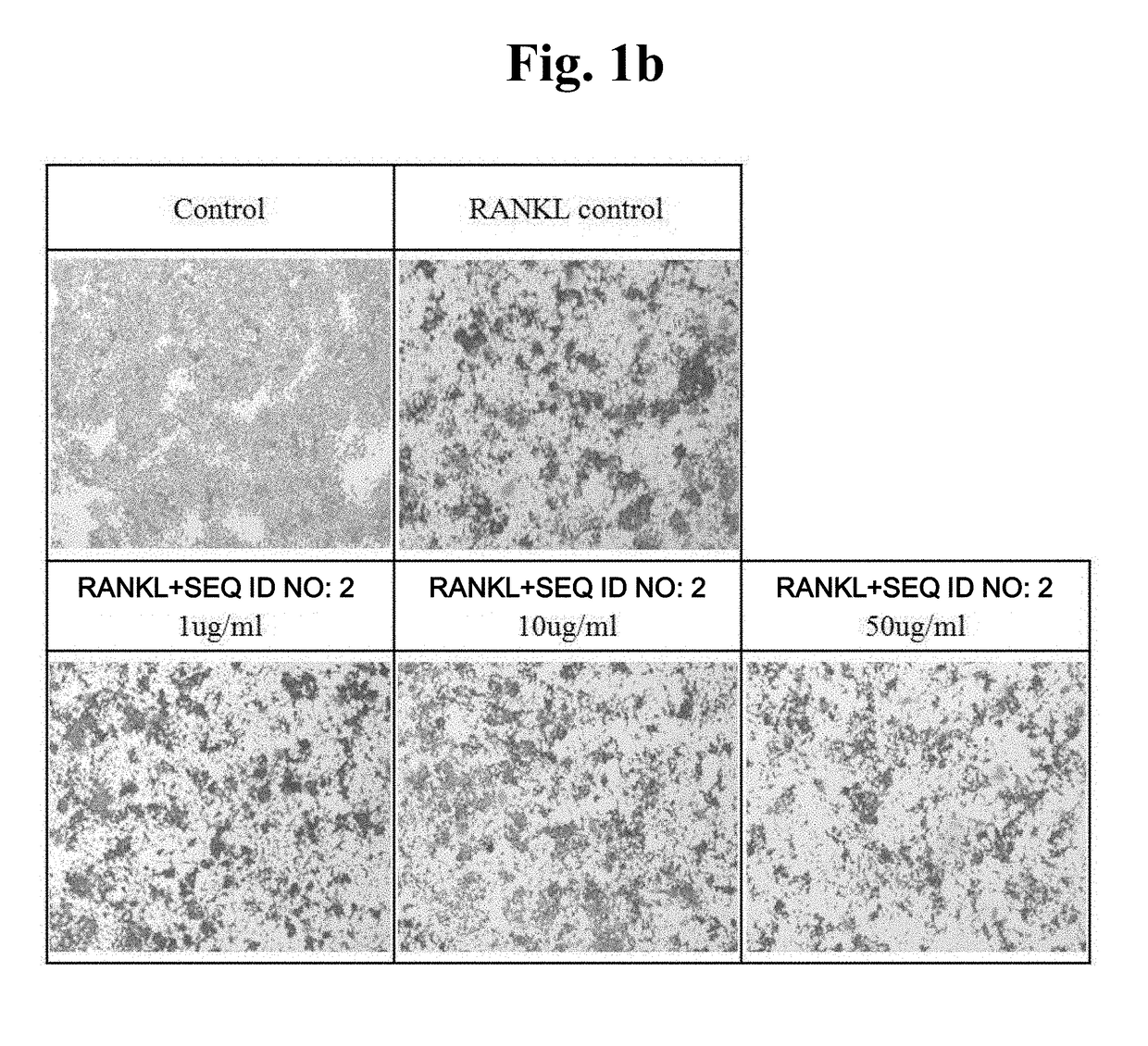 Peptide having osteoclast differentiation and activation inhibition, and use of same