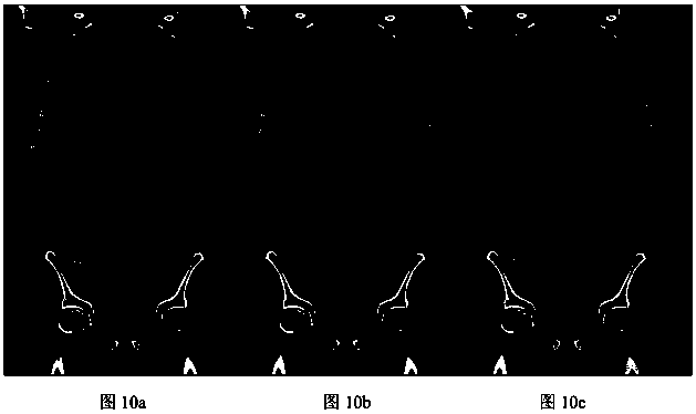 Convolutional neural network-based low-dosage CT image noise inhibition method