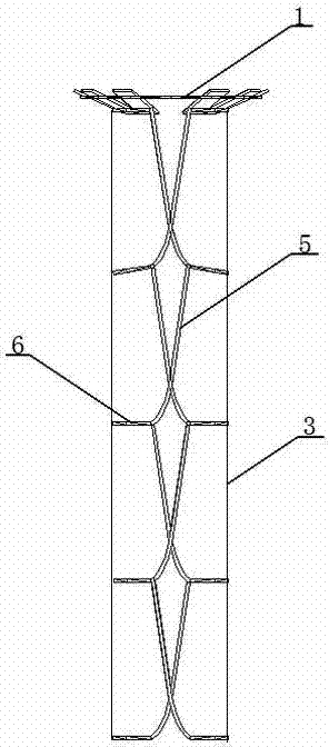 Self-retracting intraesophageal bracket capable of carrying radiation elements for partial radiotherapy