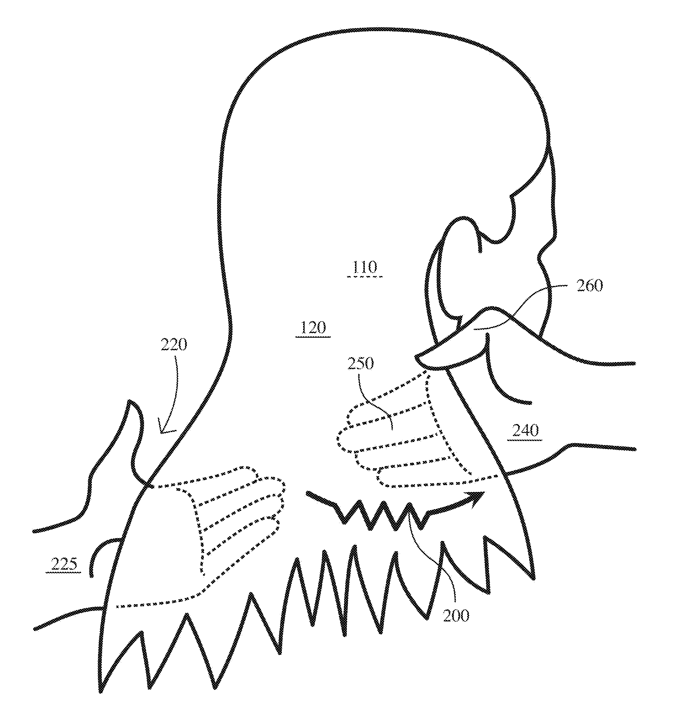 Method of follicular muscle and nerve stimulation