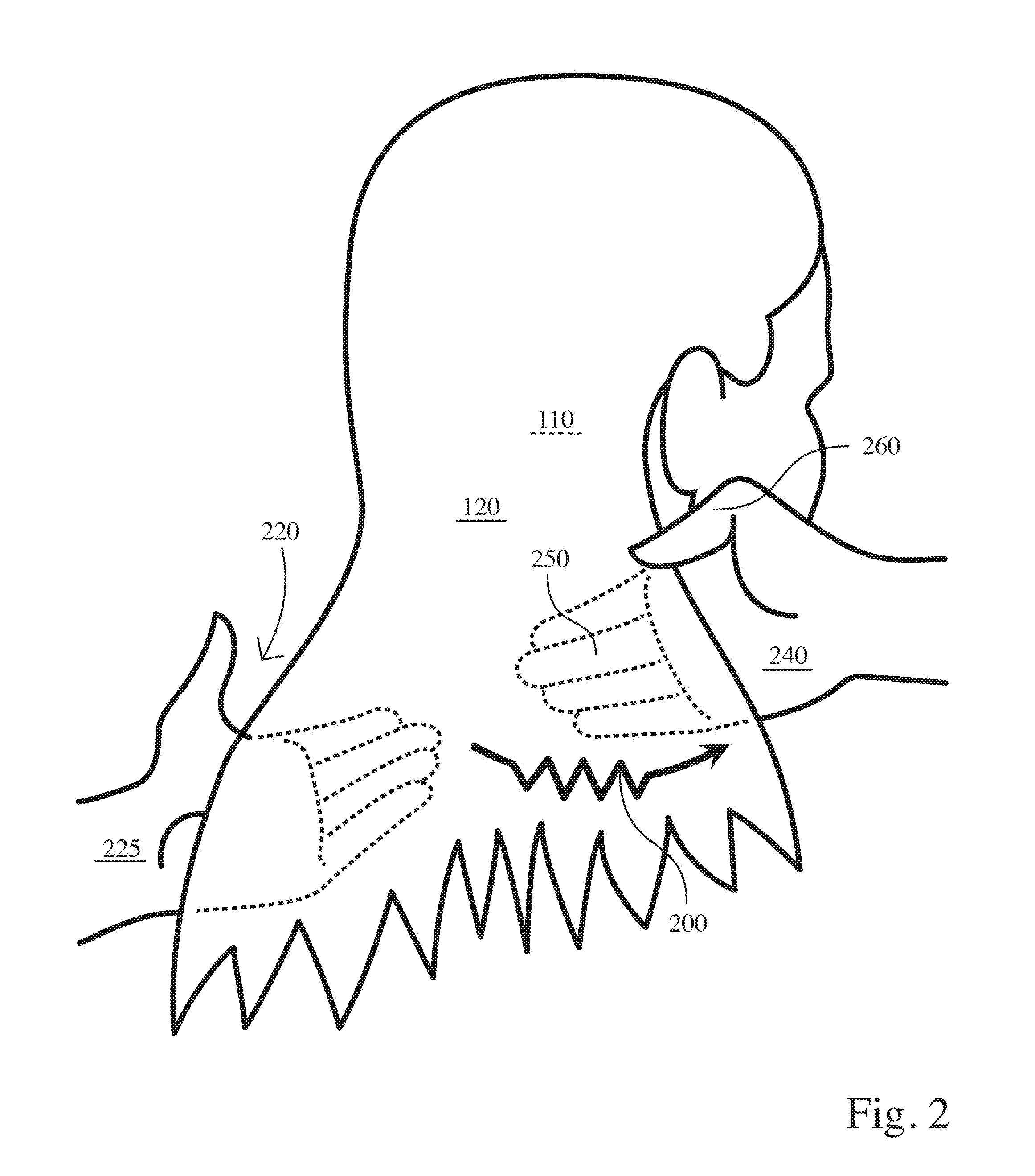 Method of follicular muscle and nerve stimulation