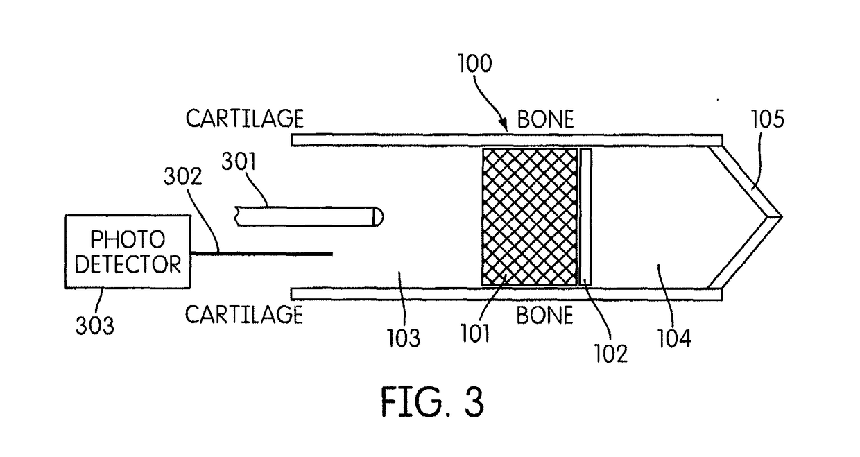 Earpiece and method for forming an earpiece