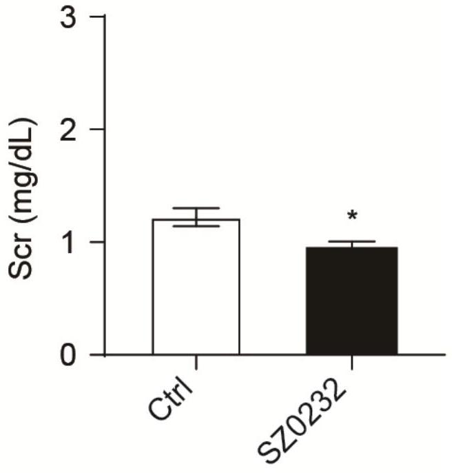 Application of benzenesulfonamide compound in preparation of medicine for treating acute kidney injury