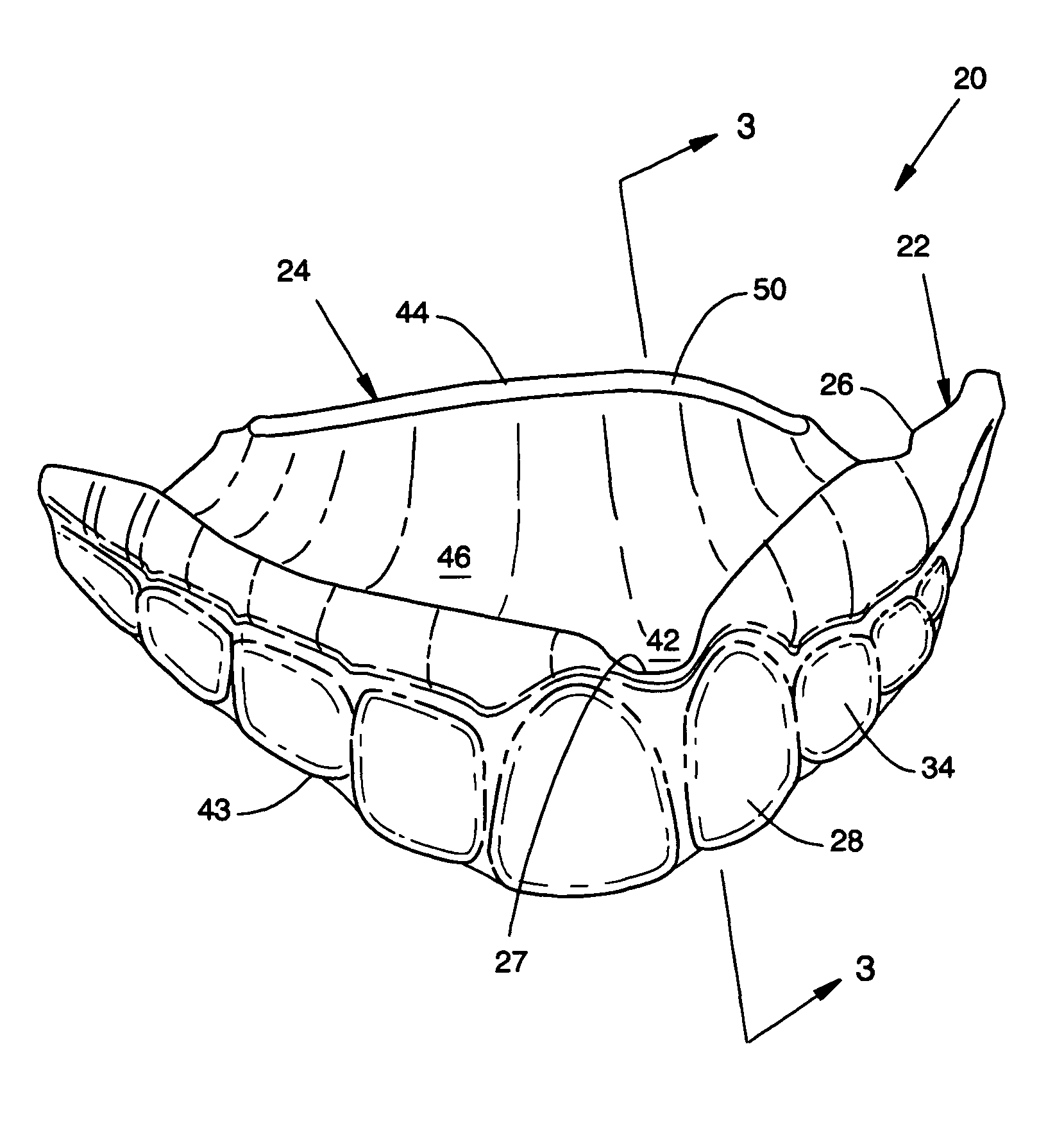 Custom mouthguard