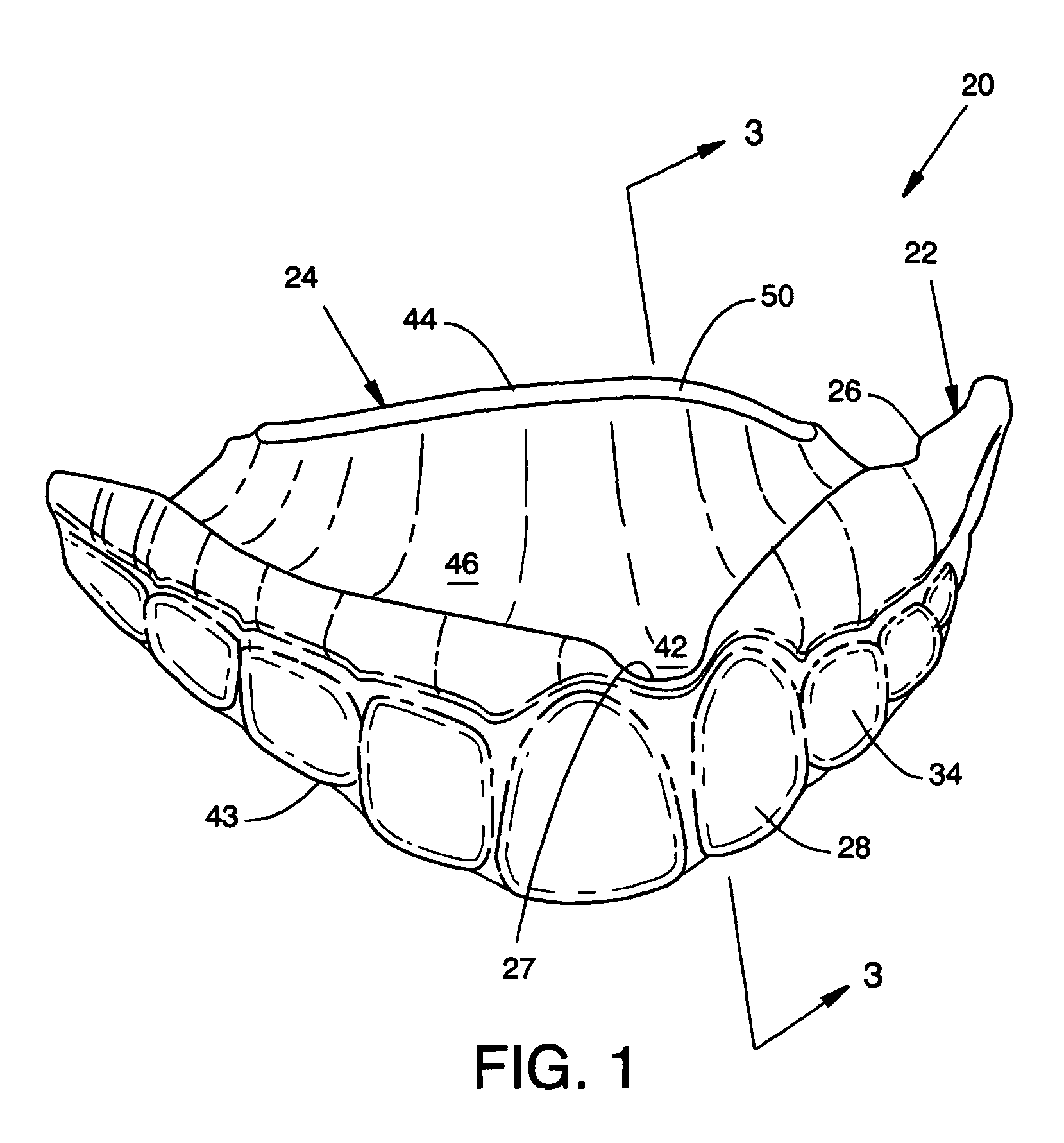 Custom mouthguard