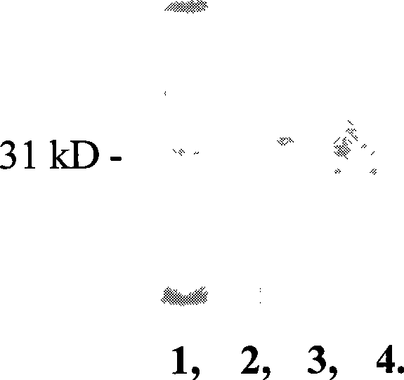 Vegetable proteins extracted from P.octandra, preparation method and application thereof