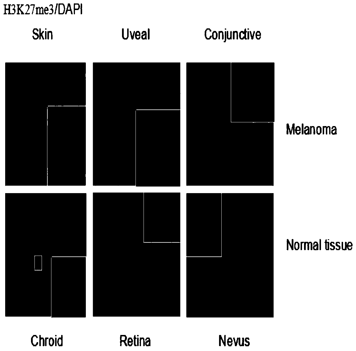 Application of ezh2 inhibitor compound in preparation of medicament for treating ocular melanoma