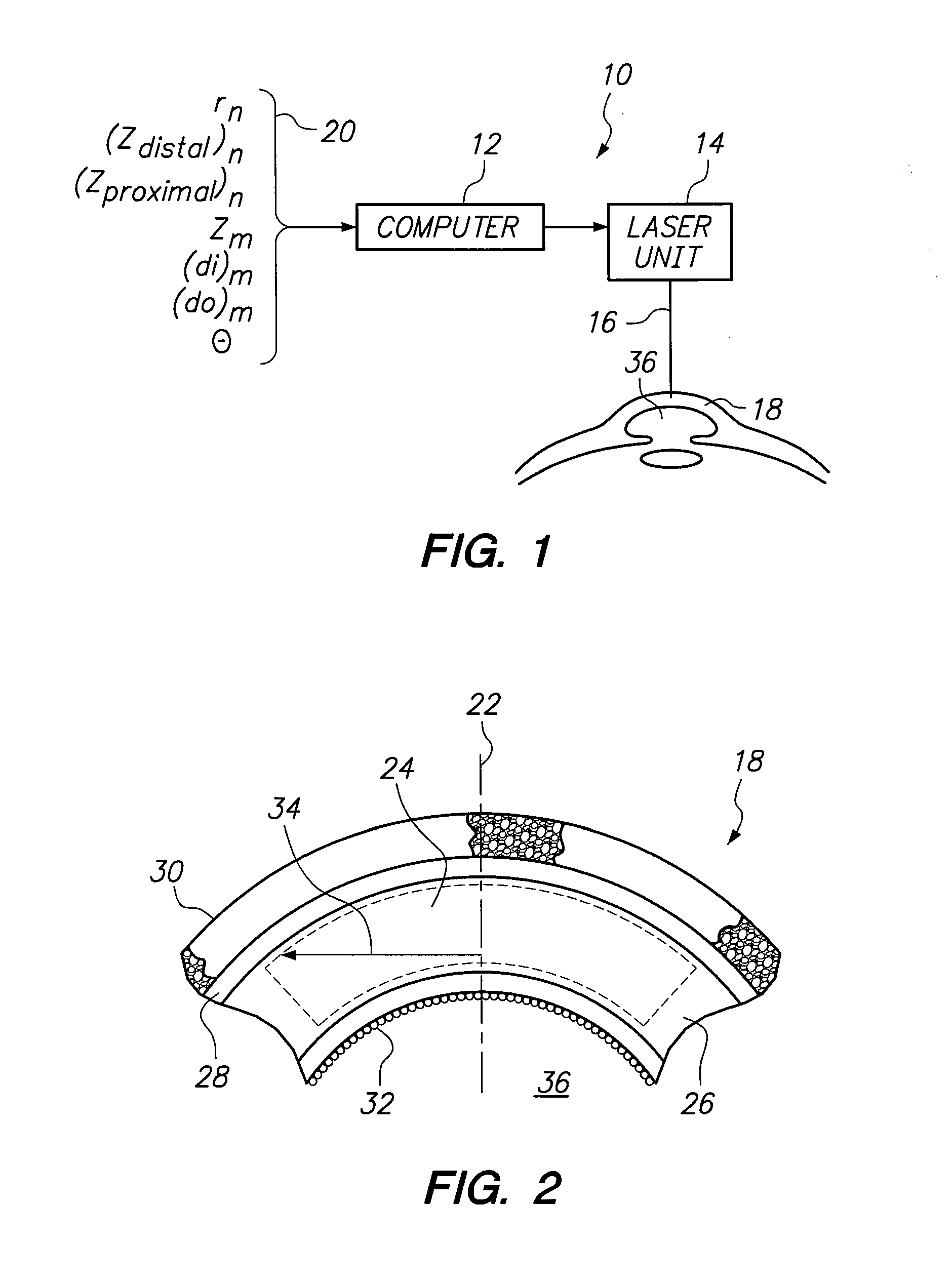 Computer control for bio-mechanical alteration of the cornea