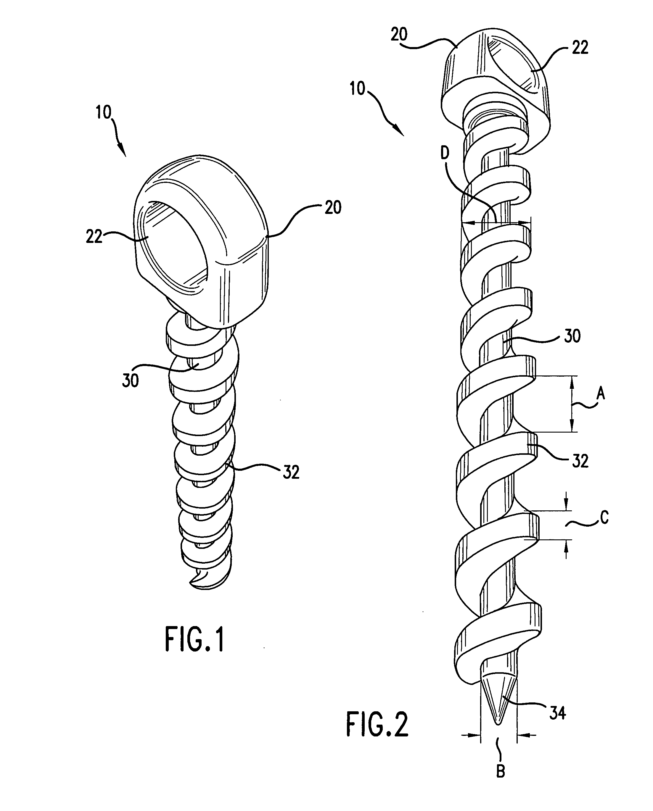 Reusable threaded tie down