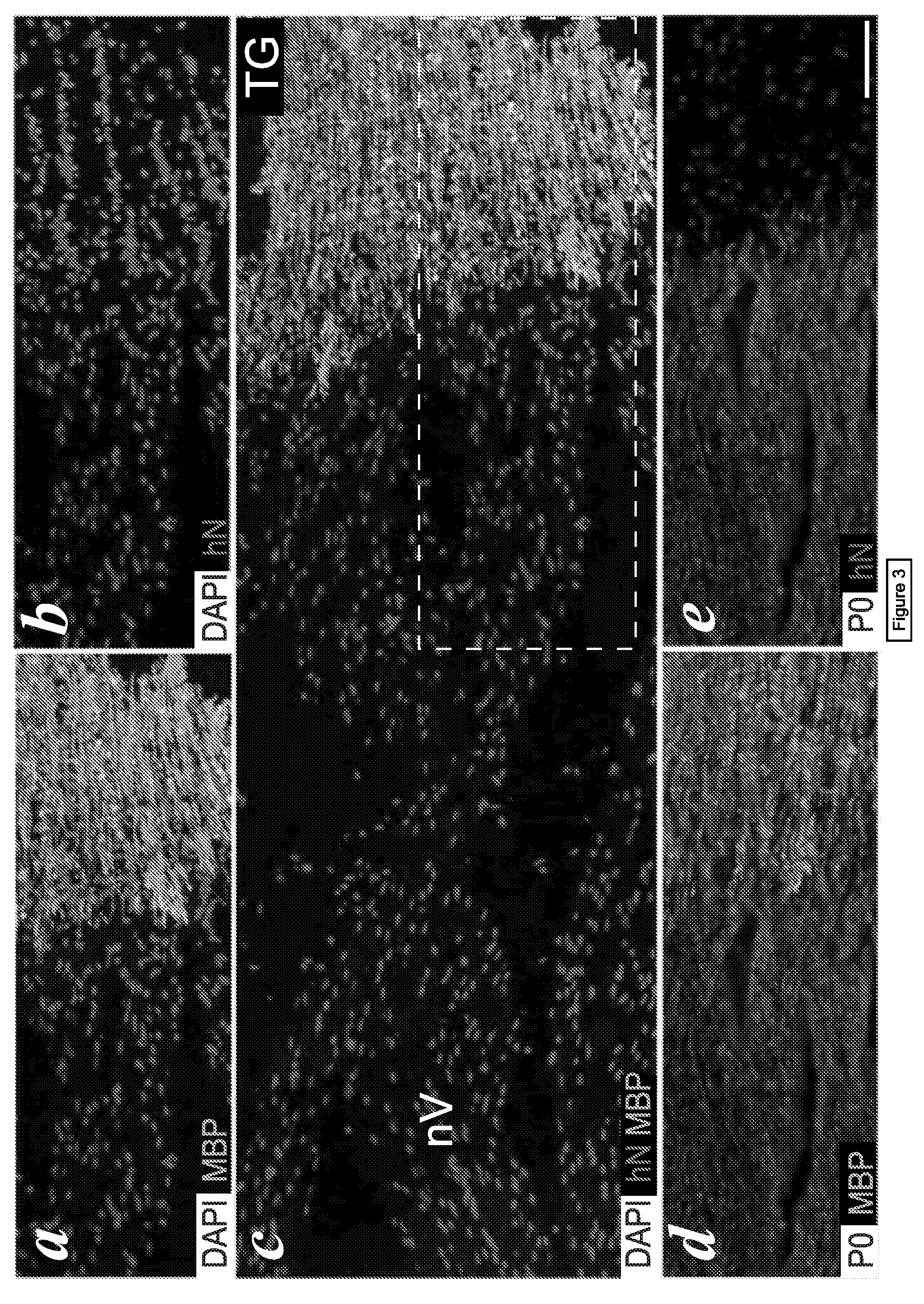 Non human animals with human-glial chimeric brains