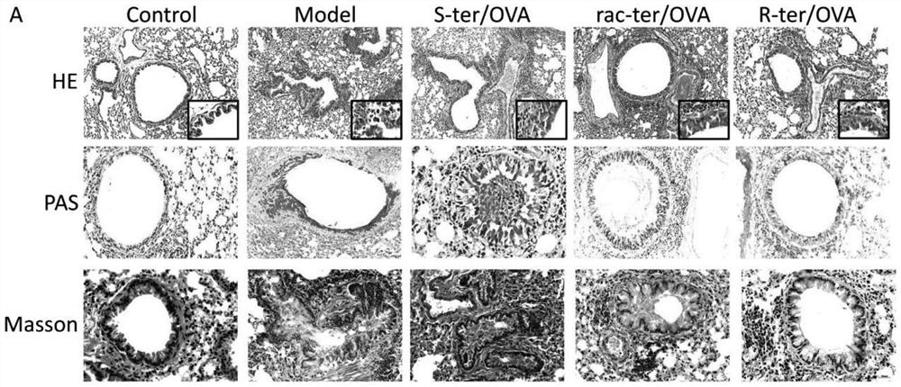 Use of r-enantiomer beta2-agonists for prevent and treatment of pulmonary inflammation and inflammatory remodeling for reduced adverse effects