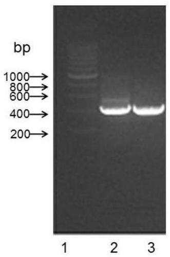 Anti-human CD26 antibody and application of anti-human CD26 antibody in detection kit