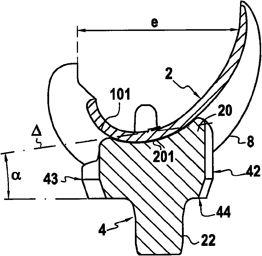 Total knee prosthesis