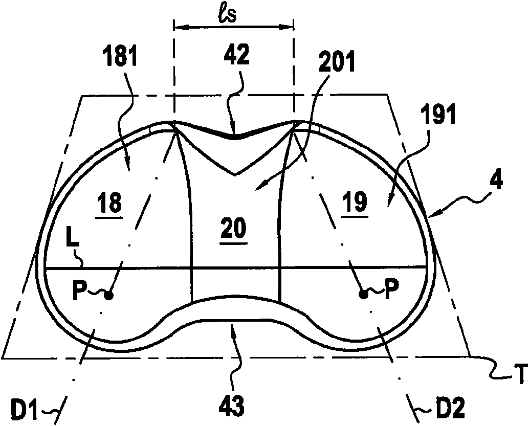 Total knee prosthesis