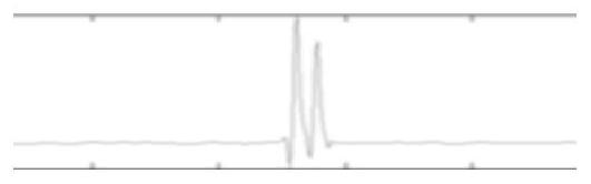 A Wavelet Resolution Processing Method Based on Angle Entropy