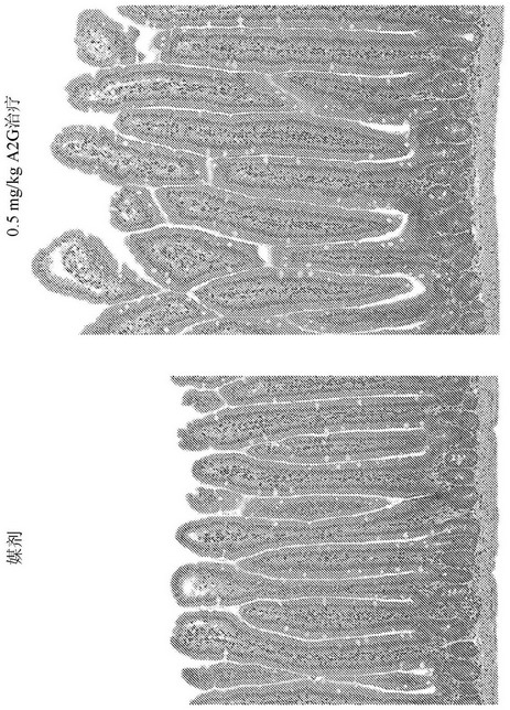 GLP-2 analogs and peptibodies for administration before during, or after surgery