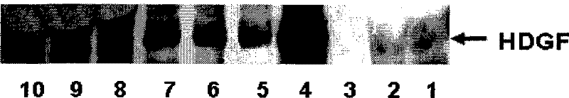 Monoclonal antibody of hepatoma-derived growth factor and use thereof