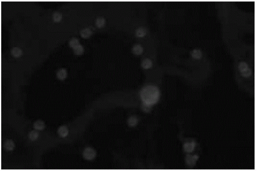 Preparation method and storage method of immunomagnetic beads for leucocyte sorting