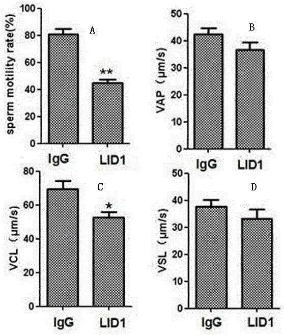 Immunogens used to prepare lrrc52 polyclonal antibodies