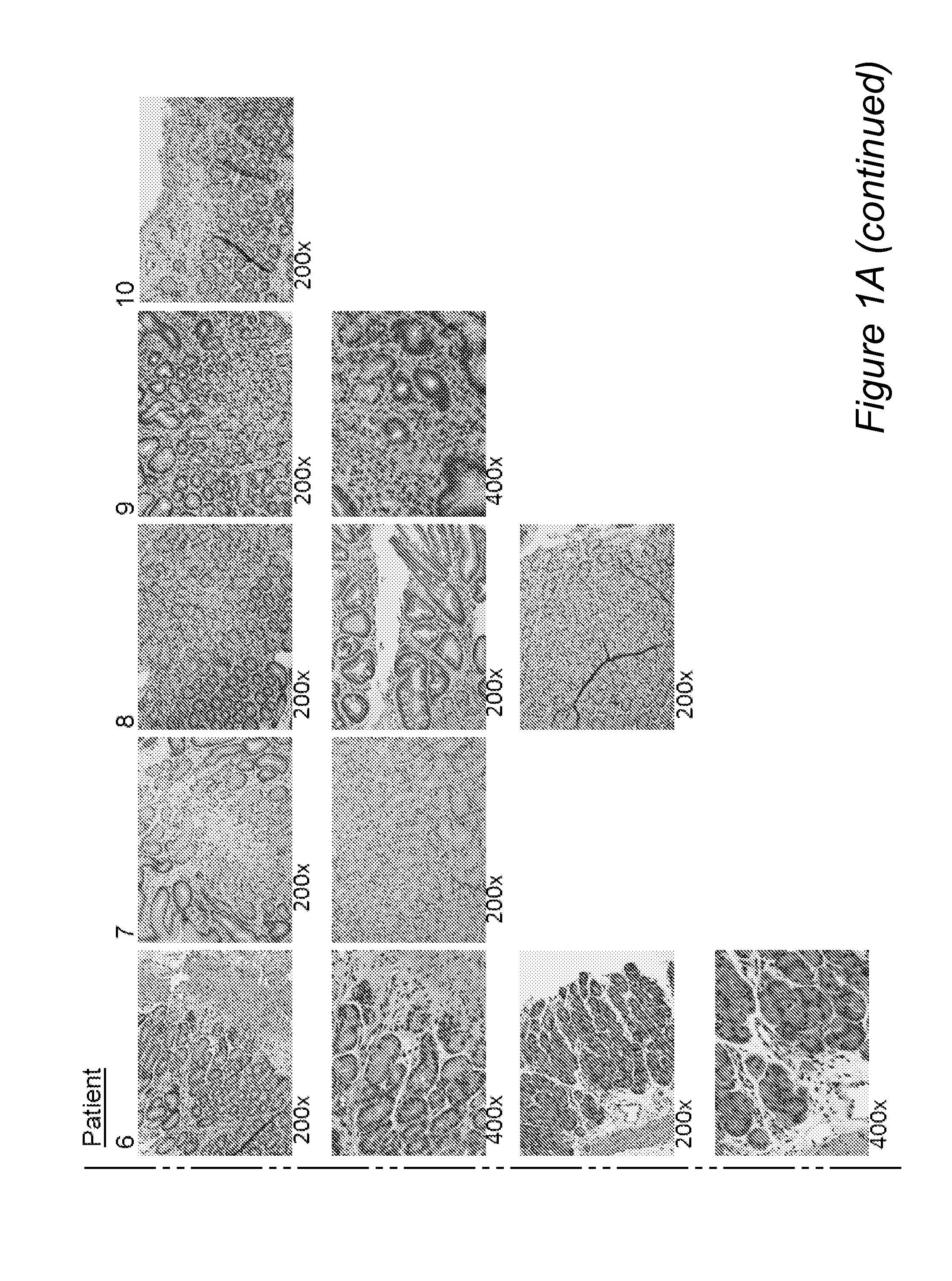 Molecular diagnostic panel of eosinophilic gastrointestinal disorders