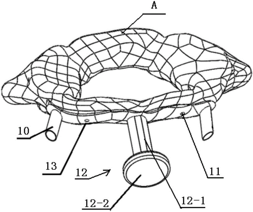 Metal guide plate capable of improving screw-setting precision in spinal operation and manufacturing method of metal guide plate