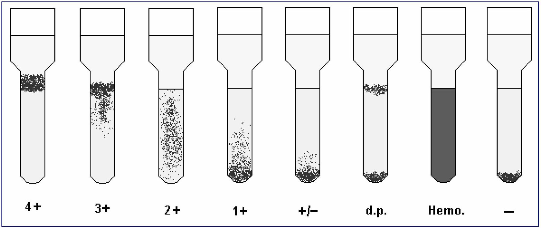 Broad spectrum antihuman globulin reagent assay card and preparation thereof