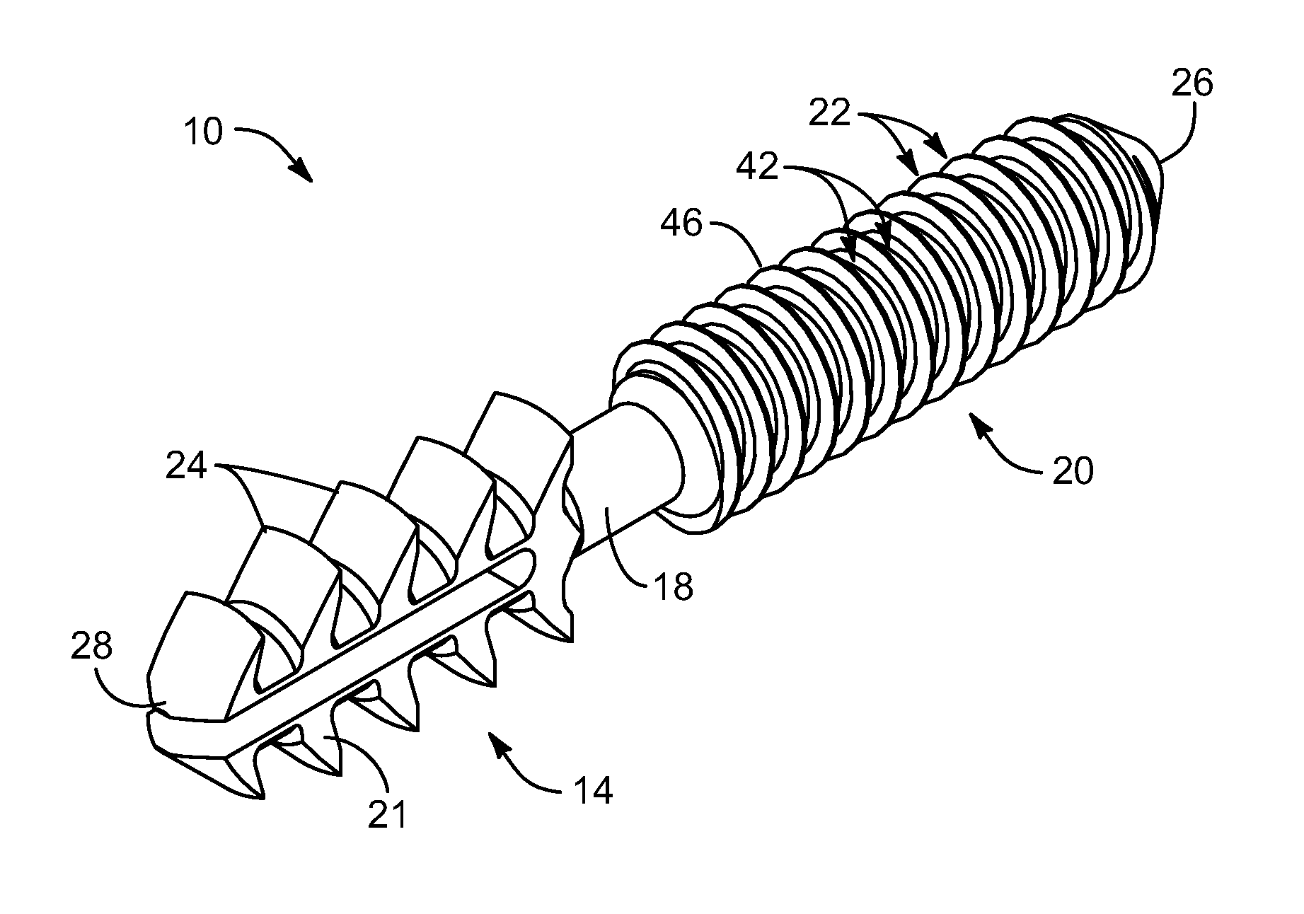 Arthrodesis implant apparatus and method