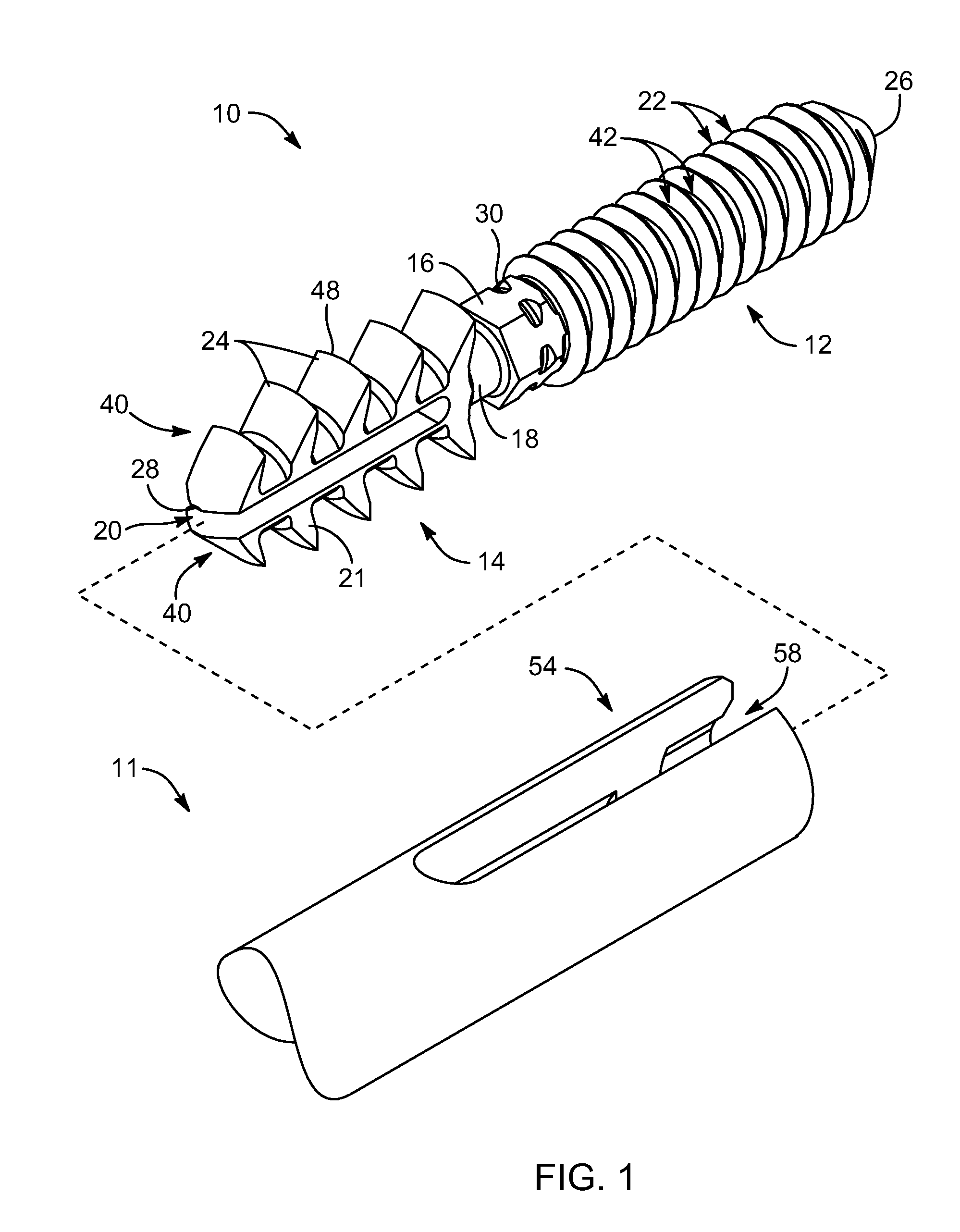 Arthrodesis implant apparatus and method