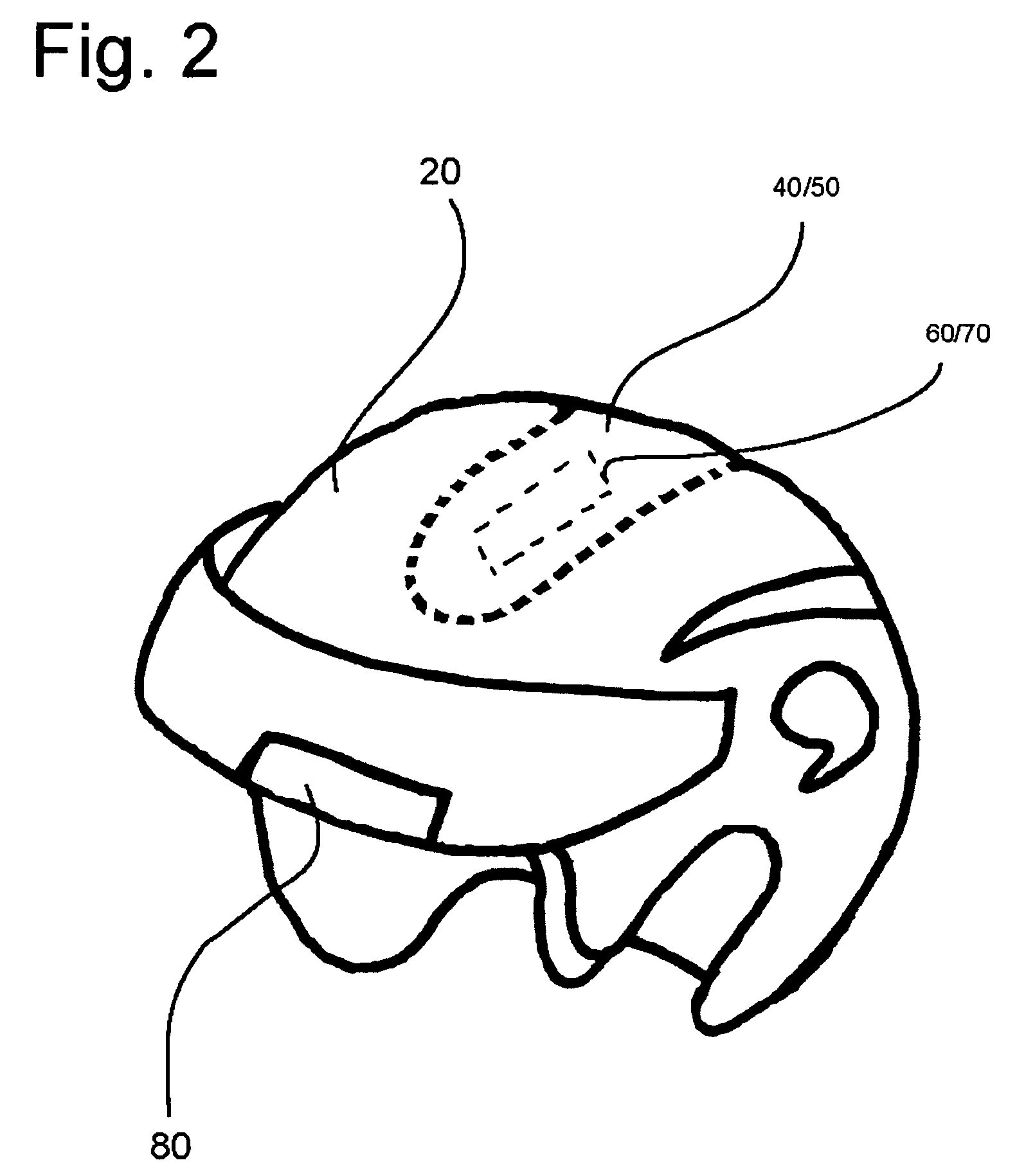 Helmet system