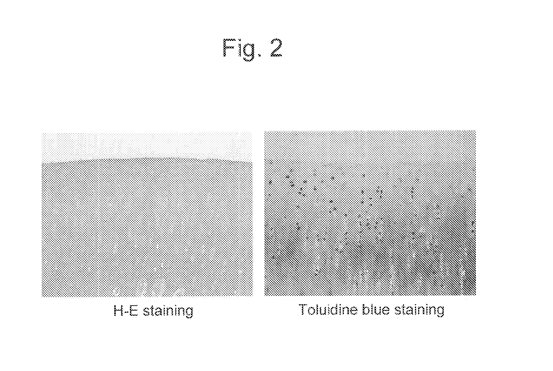 Combined preparation for treating joint diseases