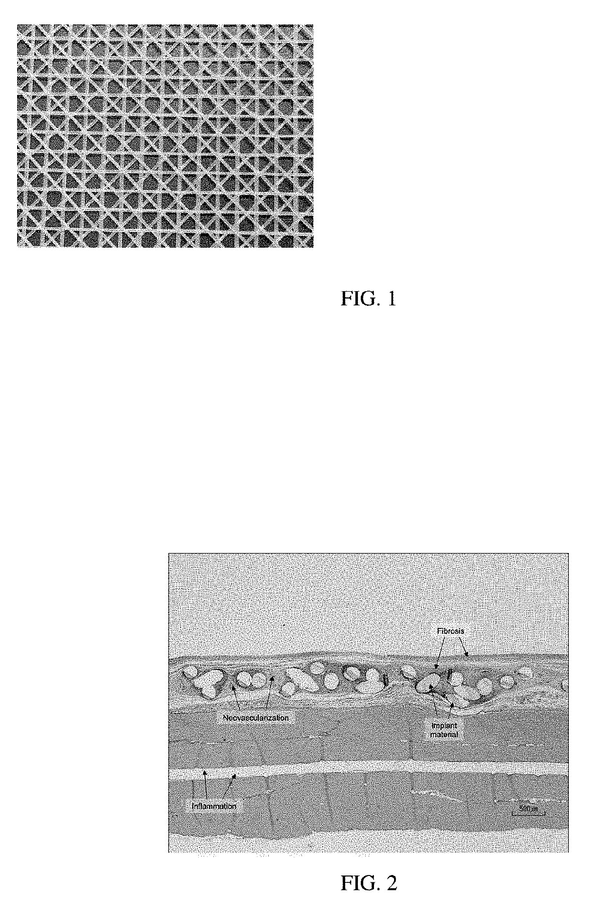 Surgial mesh implants containing poly(butylene succinate) and copolymers thereof