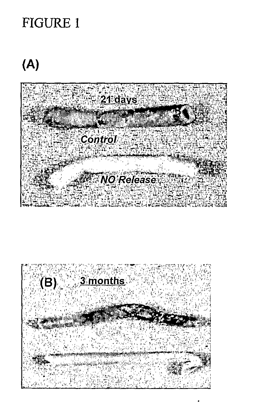 Methods, Compositions and Devices For Promoting Anglogenesis