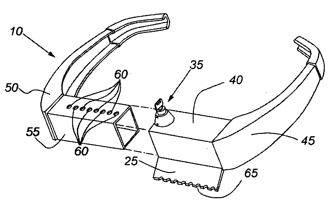 Locking wheel chock