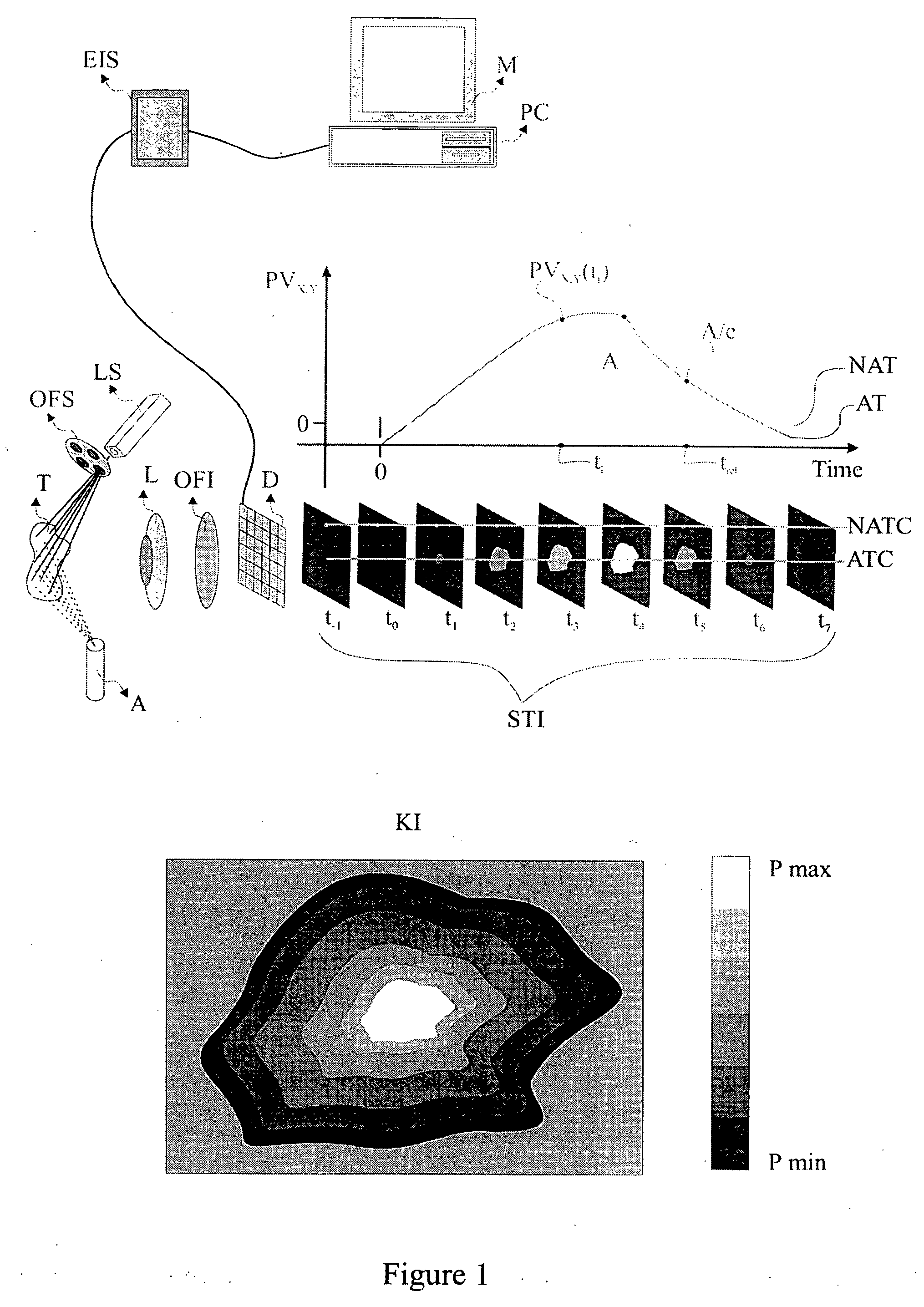 Method and system for characterization and mapping of tissue lesions